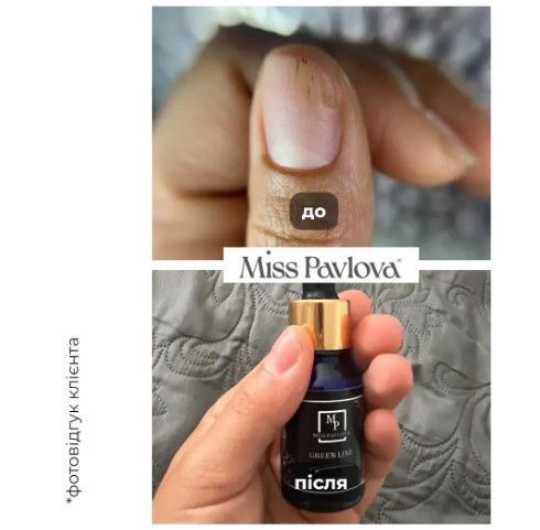 Олія лікувальна від оніхолізіса Монарда 100% Miss Pavlova, 5 мл